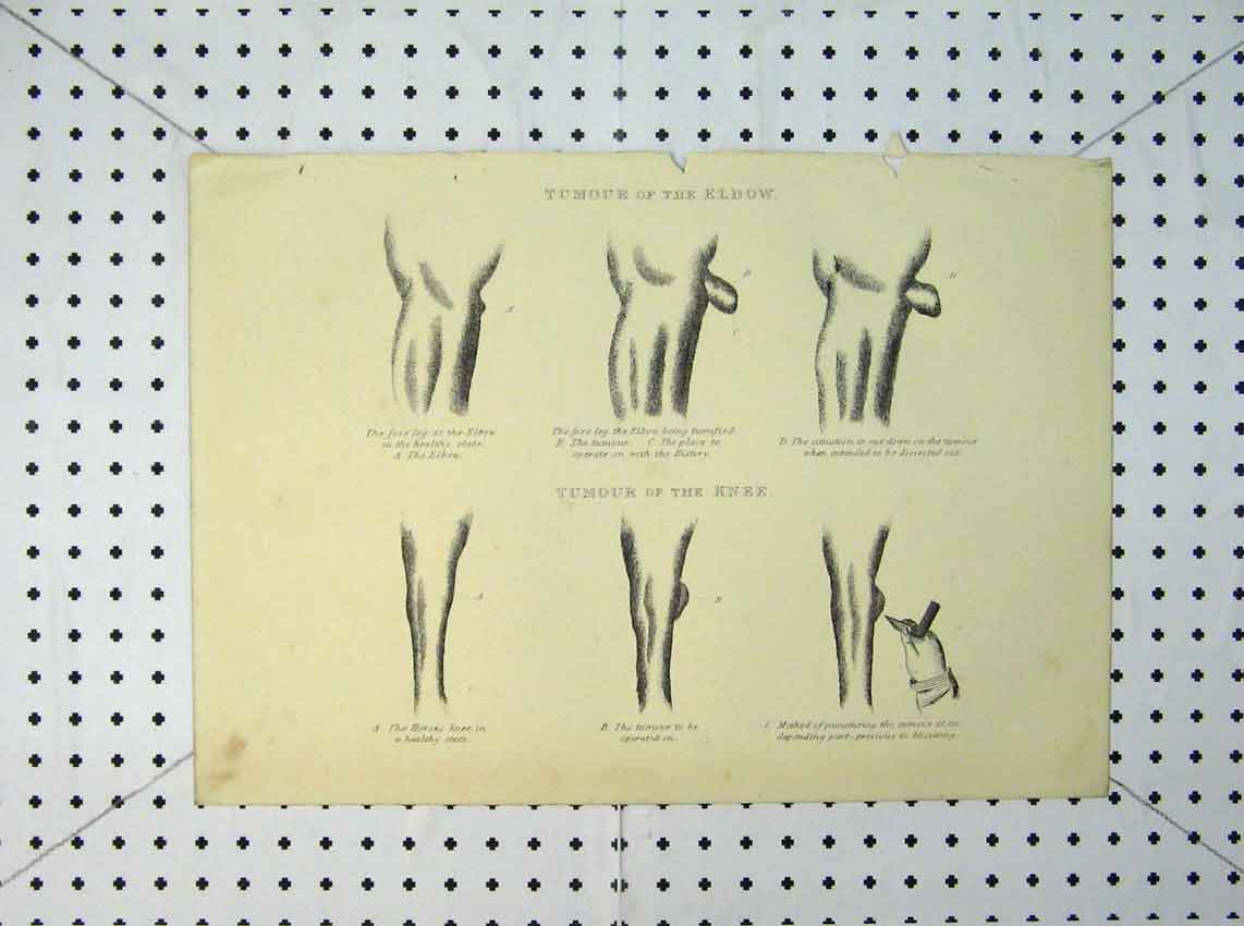 Original Old Antique Print Horse 1816 Tumour Elbow Knee Leg Medical 19th