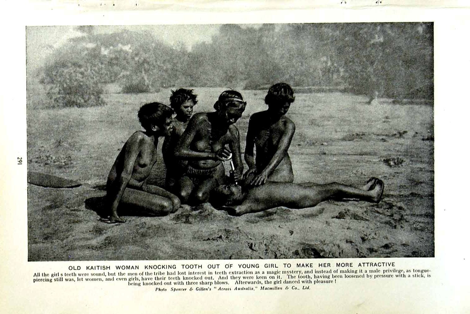 Original Old Vintage Print C1920 Kaitish Woman Teeth Extraction Australia Totem