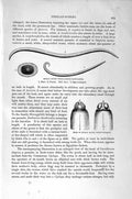 Original Old Antique Print Natural History 1896 Human Round Worm Cucullanus
