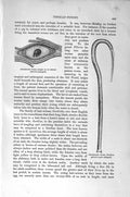 Original Old Antique Print Natural History 1896 Trichinosis Worm Gordius Larvae