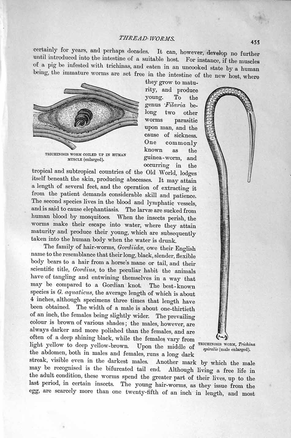 Original Old Antique Print Natural History 1896 Trichinosis Worm Gordius Larvae