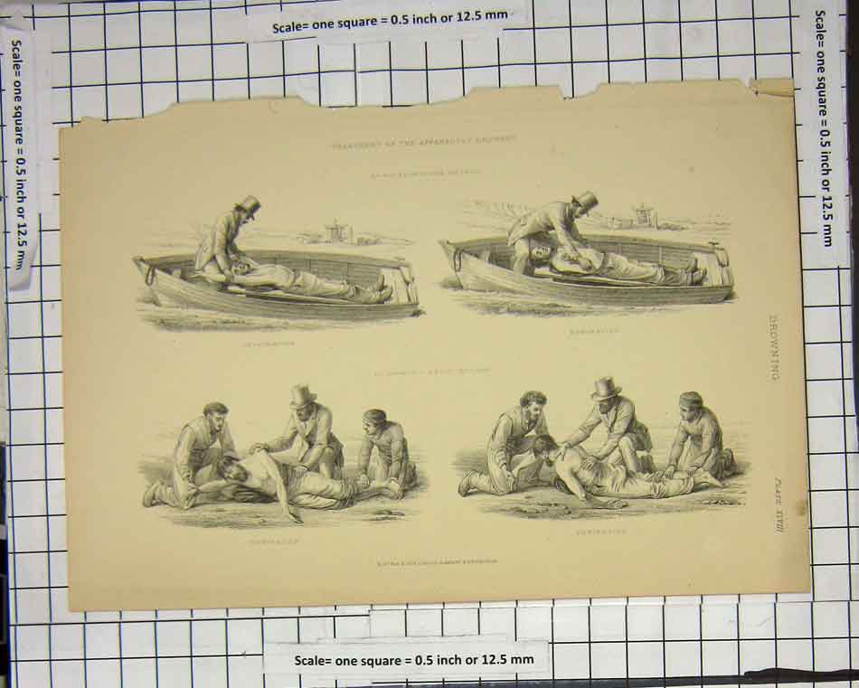Original Old Antique Print Treatment Drowned Positions Doctor