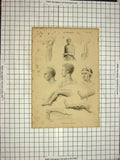 Original Old Antique Print Surgery Human Body Medicine Doctor Man Bandages