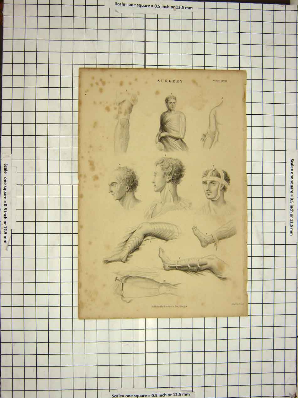 Original Old Antique Print Surgery Human Body Medicine Doctor Man Bandages