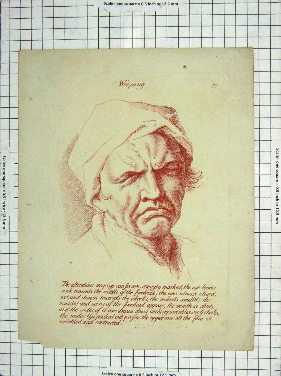 Original Old Antique Print Portrati Man Weeping Eye-Brows Forehead Victorian