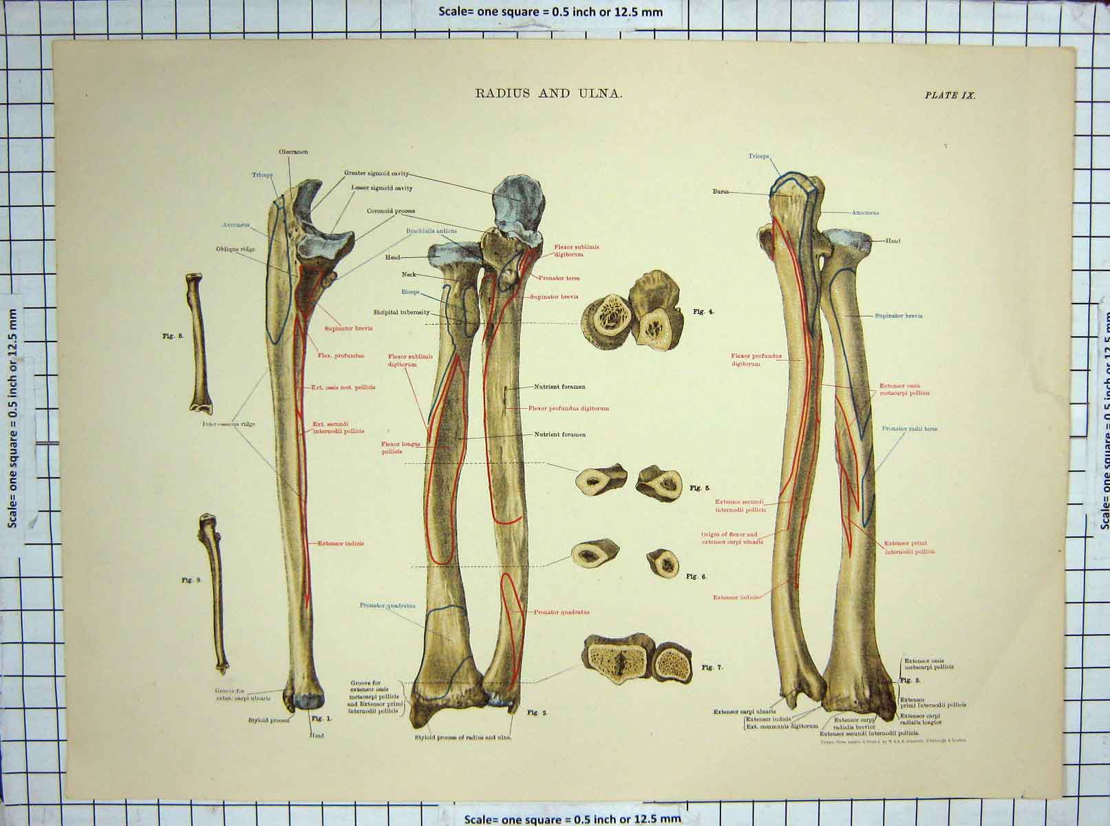 Original Old Antique Print Radius Ulna Human Bones Arm Biology
