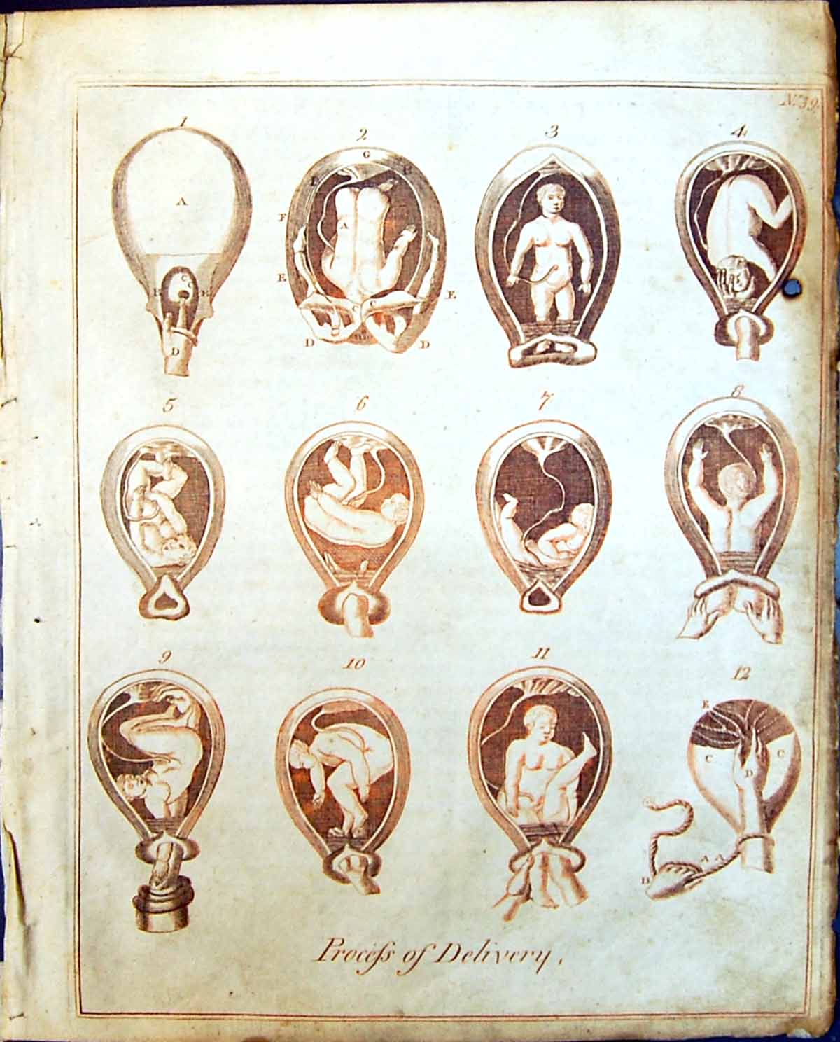 Original Old Antique Print Culpeper C1857 Process Delivery Baby Human Body 19th