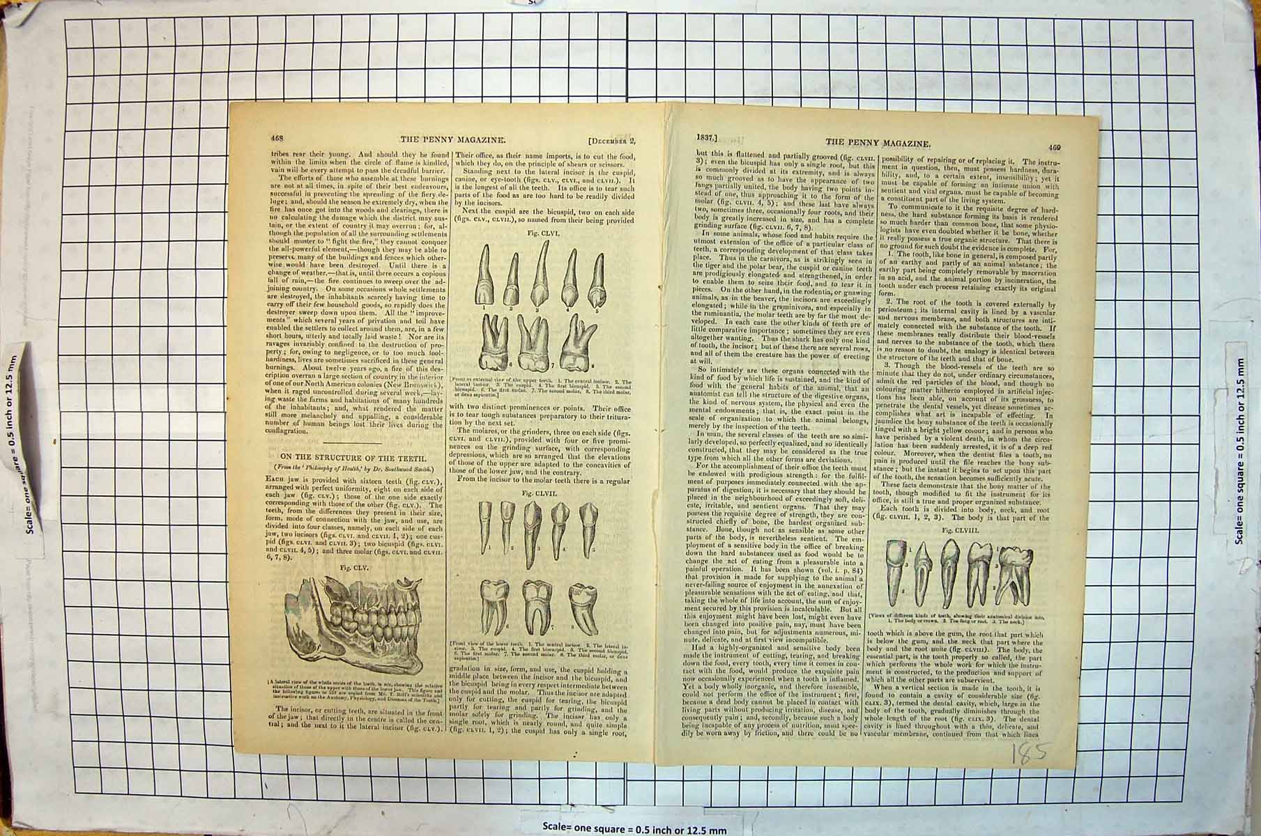 Original Old Antique Print Structure Teeth Incisor Cuspid Molar Human Body 19th