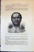 Old Cafre Moulage Museum Naturelle Paris 1880 Human Races Humaines Fi Victorian