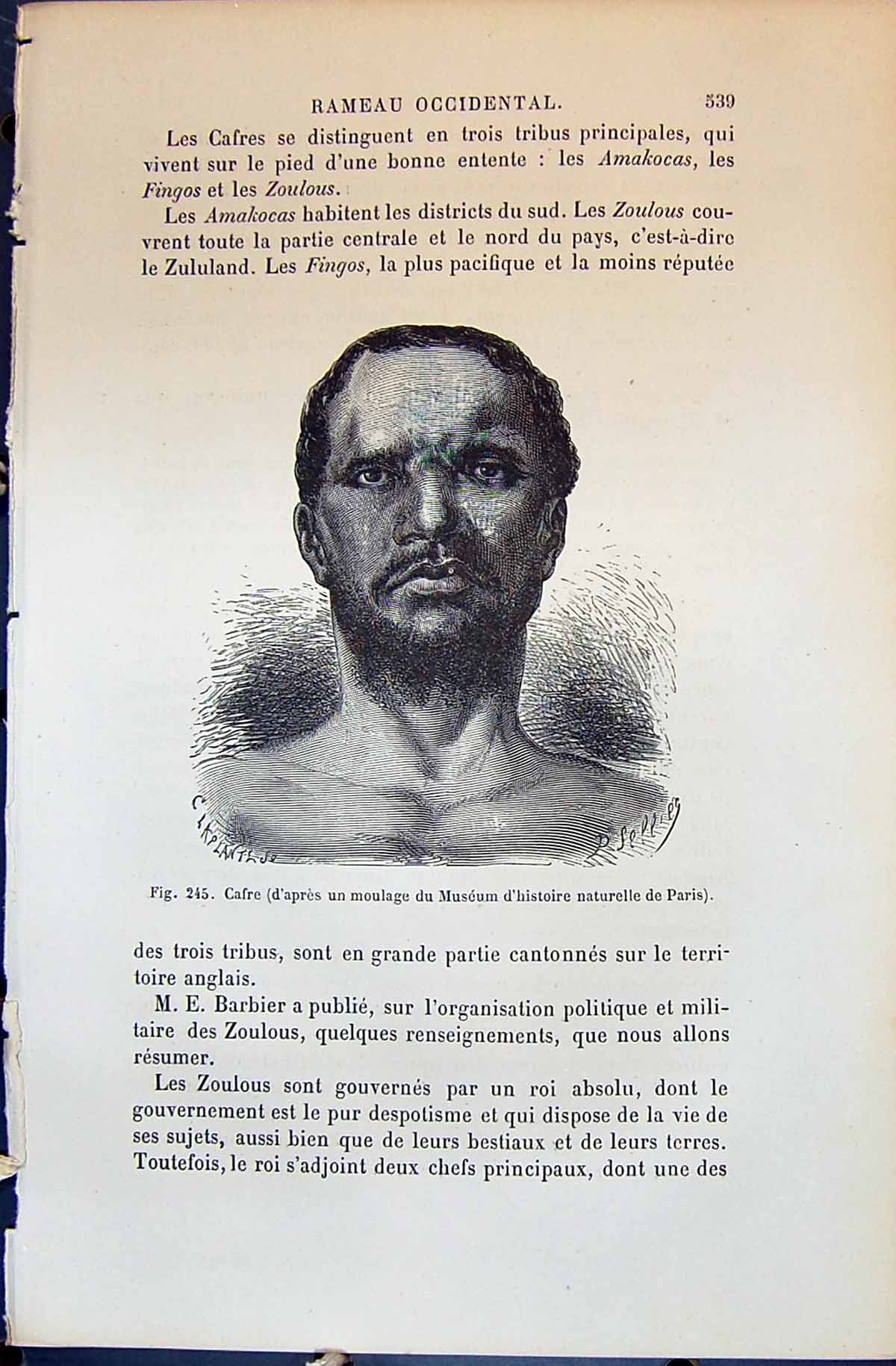 Old Cafre Moulage Museum Naturelle Paris 1880 Human Races Humaines Fi Victorian