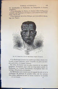 Old Naturel Cote Mozambique Pritchard Man 1880 Human Races Humaines F Victorian