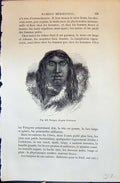 Old Patagon D'Apres Pritchard Percement L'Oreille 1880 Human Races Hu 19th