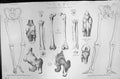 Old Mackenzie C1880 Science Leg Skeleton Bones Hip Knee Joint Thigh P Victorian