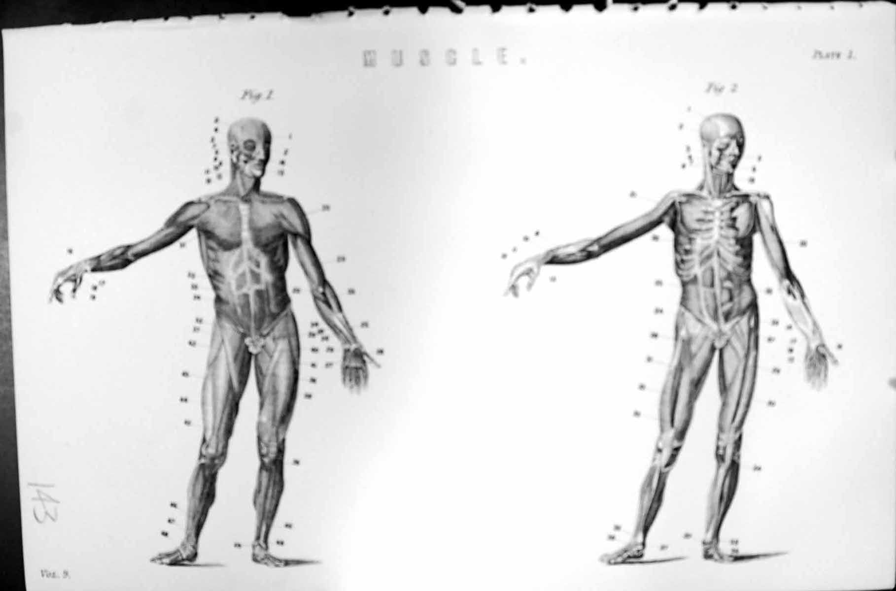 Original Old Antique Print Human Body Muscle Biology Mackenzie C1880 Science