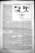 Original Old Antique Print A Scraper Plan Section View 1858 19th