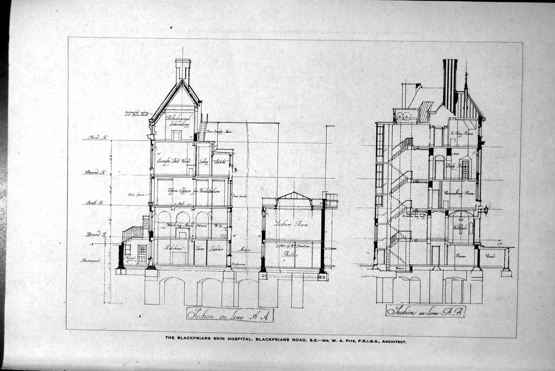 Old Blackfriars Skin Hospital Sections Plans First Second Third 1918 20th