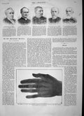 Old Antique Print 1896 Photo Bones Hand Rogers Wilberforce Castell Kerr 19th