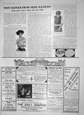 Antique Print 1910 Antexema Skin Autotype Fine Art Collier Heinemann Books 20th