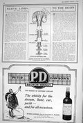 Old 1922 Diagram Path Nerves Brain Spinal Cord Peter Dawson Scotch Wh 20th