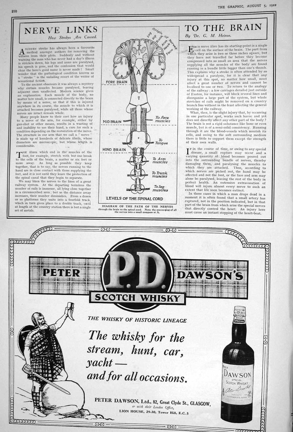 Old 1922 Diagram Path Nerves Brain Spinal Cord Peter Dawson Scotch Wh 20th