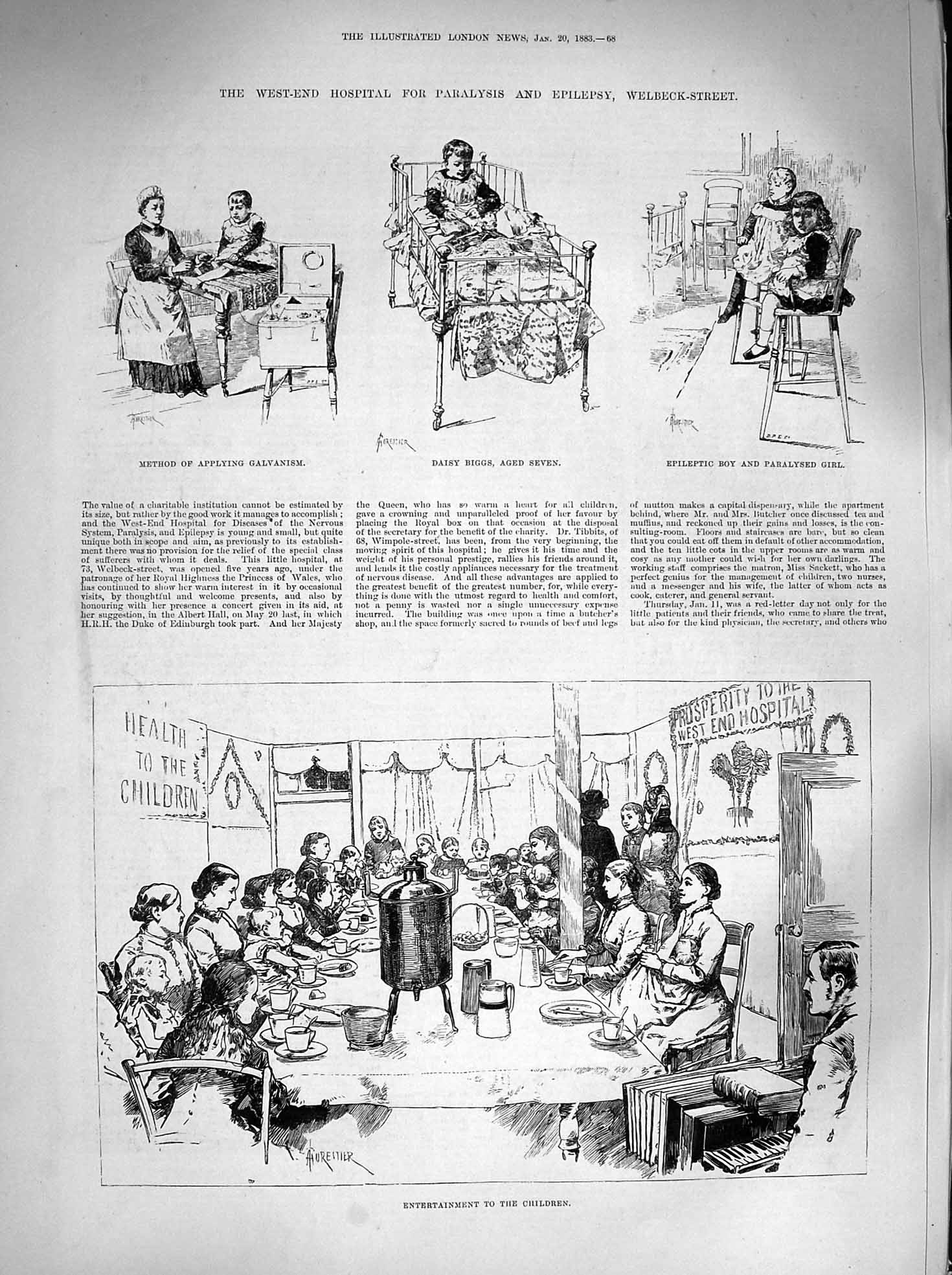 Old Antique Print 1883 London Hospital Paralysis Epilespy Welbeck Biggs 19th