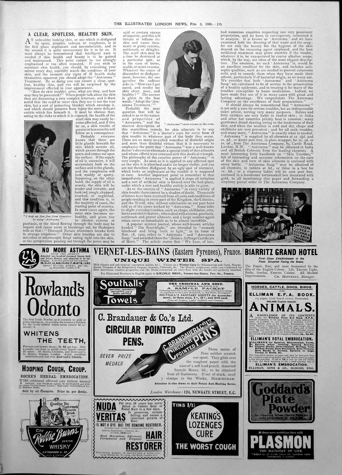 Old Antexema Cures Eczema All Skin Troubles Keatings Lozenges Cough1906 20th