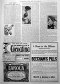 Antique Print Antexema Eczema Chaffed Hands Skin Schweitzers Cocoatina 1906