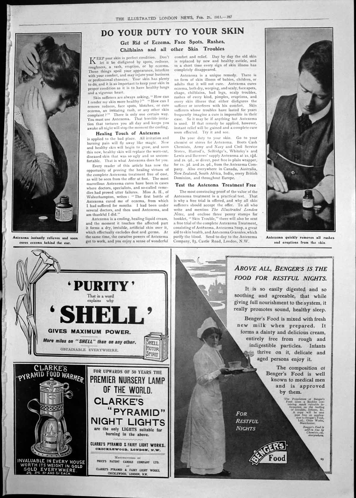 Old Antexema Advert Shell Benger'S Motor Ambulance Pretoria 1911 287RP 20th