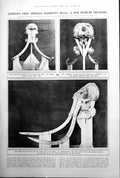 Old Londons First Siberian Skull Ramsay Macdonald Sir James Craig 1922 20th
