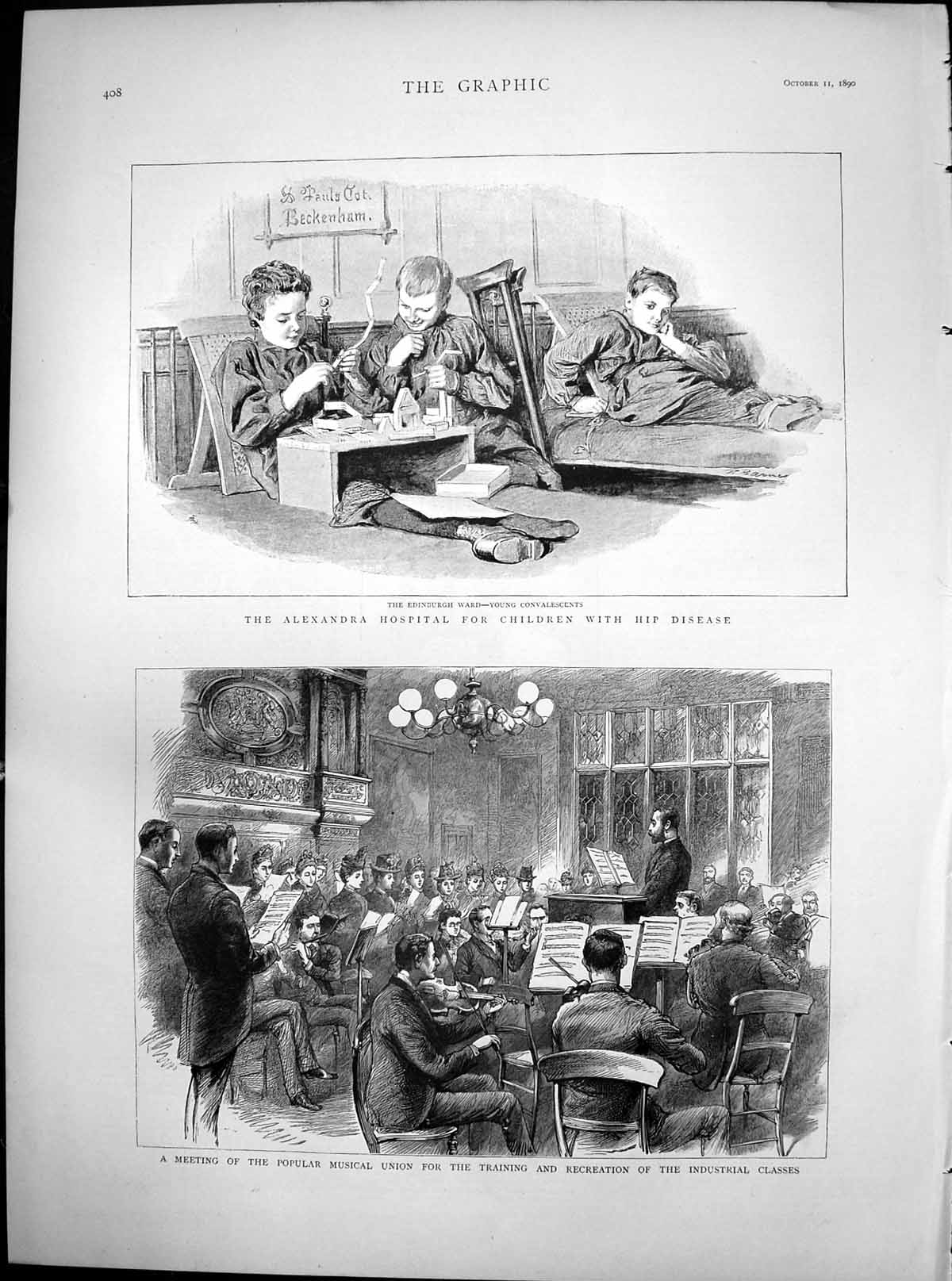 Antique Old Print Alexandra Hospital Children Hip Disease Musical Union 1890